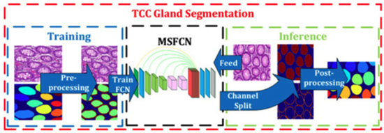 R&D in colon-rectal cancer diagnosis (POR FESR Sardegna 2014-2020)